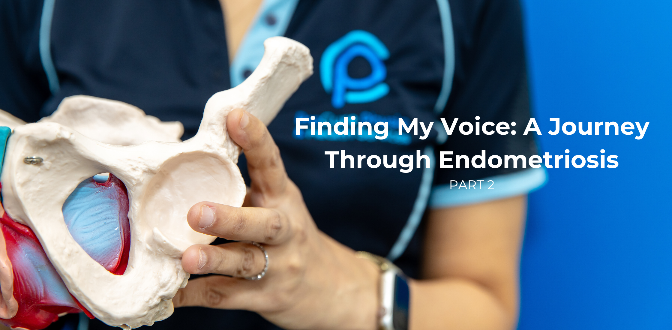 Endometriosis and treatment